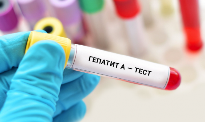 У Києві спалах гепатиту А: зафіксовано 34 випадки, зокрема 20 серед дітей