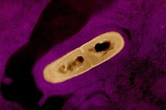 Бактерії Listeria monocytogenes під електронним мікроскопом