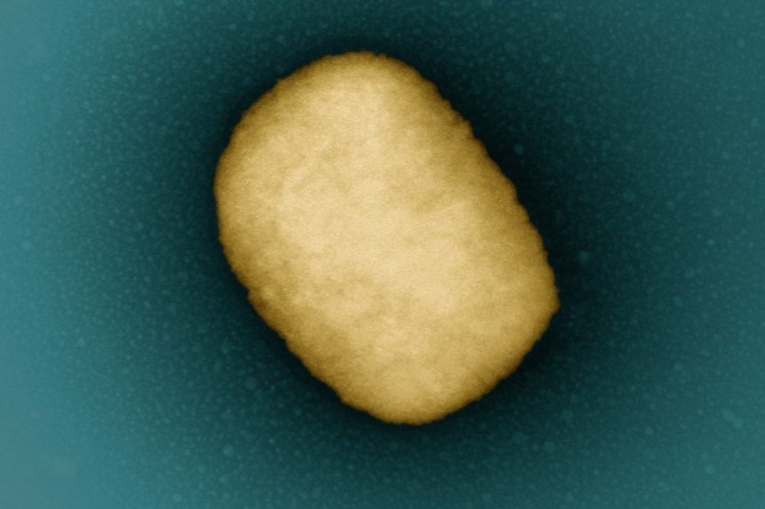 Частинка вірусу мавпячої віспи (mpox) під електронним мікроскопом, кольорове зображення NIAID